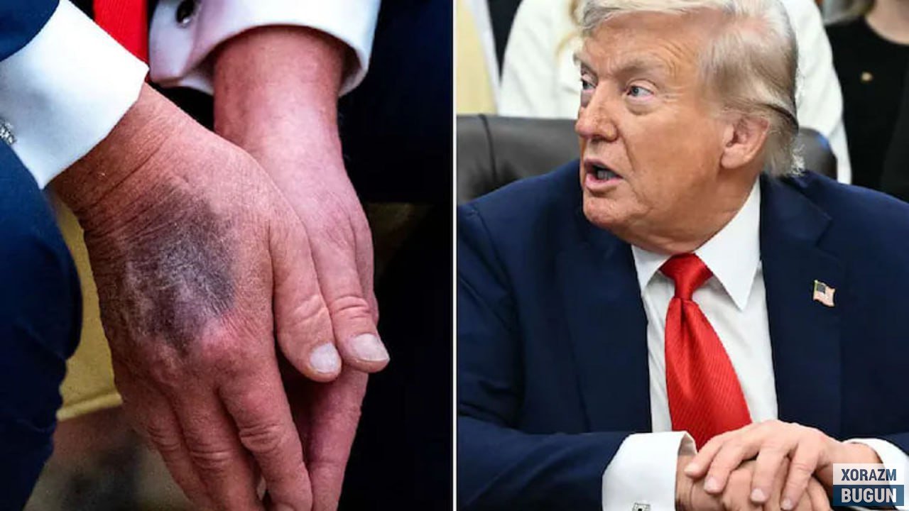 Қўлдаги кўкариш, Венснинг сирли баёноти ва байроқ туширилиши: Трампнинг вафот этгани ҳақидаги миш-мишлар нима асосида тарқалмоқда?